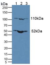 Polyclonal Antibody to Nuclear Pore Glycoprotein 210 (gp210)