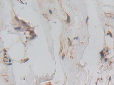 Polyclonal Antibody to Interferon Alpha/Beta Receptor 1 (IFNa/bR1)