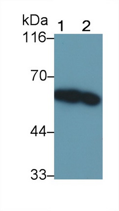 Polyclonal Antibody to Interferon Alpha/Beta Receptor 1 (IFNa/bR1)