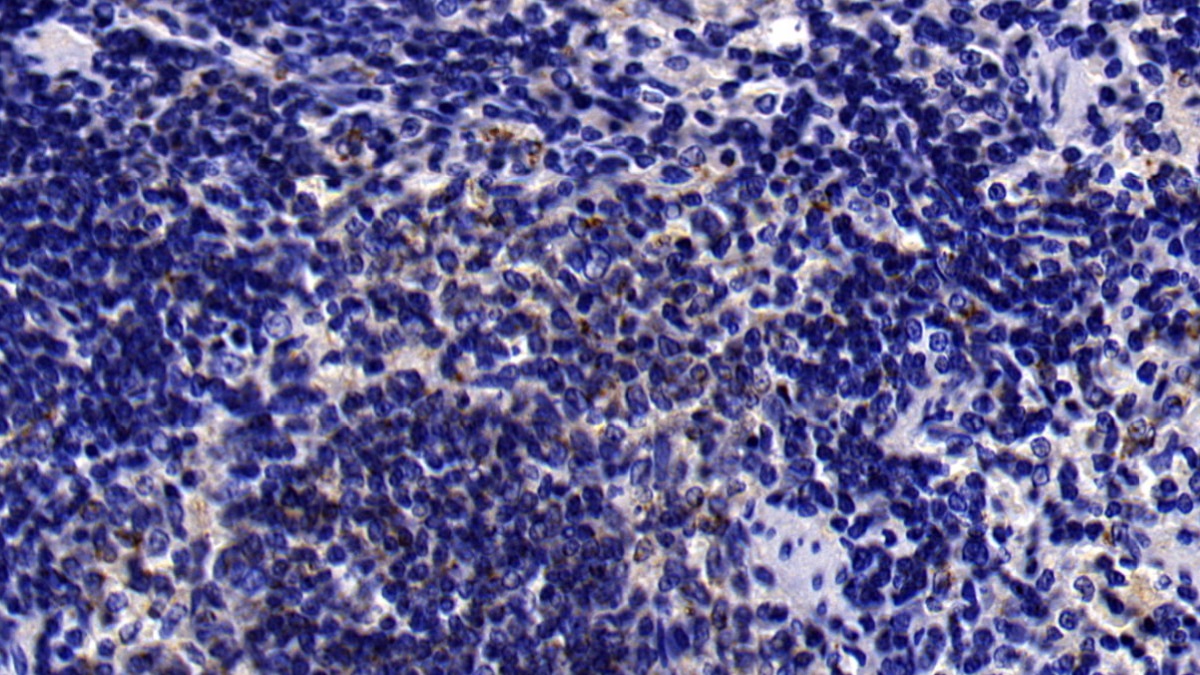 Polyclonal Antibody to Interferon Alpha/Beta Receptor 1 (IFNa/bR1)