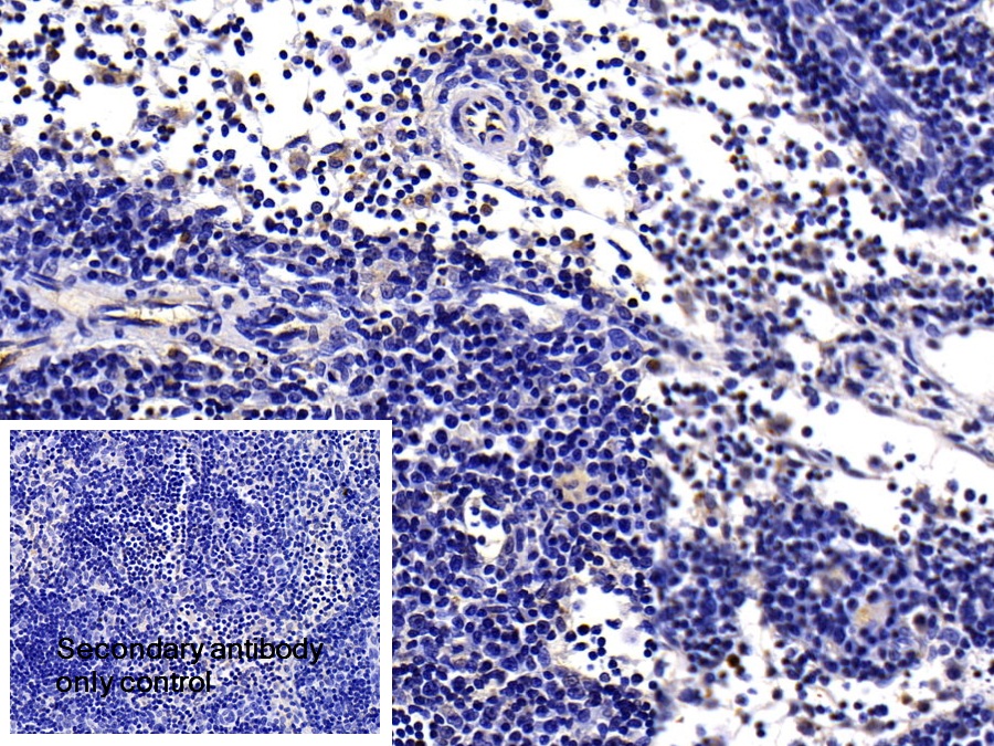 Polyclonal Antibody to Interferon Alpha/Beta Receptor 1 (IFNa/bR1)