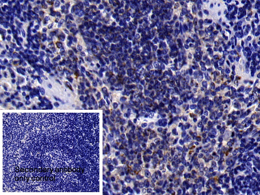 Polyclonal Antibody to Interferon Alpha/Beta Receptor 1 (IFNa/bR1)