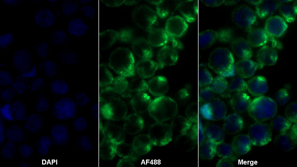 Polyclonal Antibody to Cluster Of Differentiation 99 (CD99)