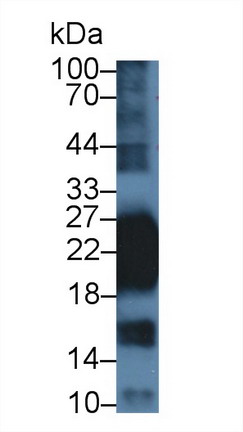 Polyclonal Antibody to Cluster Of Differentiation 99 (CD99)