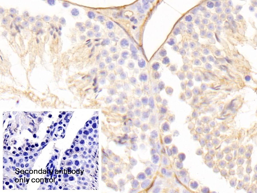 Polyclonal Antibody to Cluster Of Differentiation 99 (CD99)