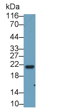 Polyclonal Antibody to Cluster Of Differentiation 99 (CD99)