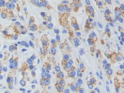 Polyclonal Antibody to Adenylate Cyclase 9 (ADCY9)