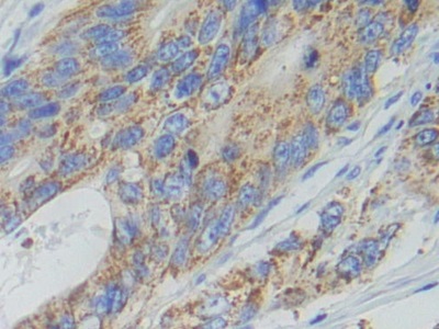 Polyclonal Antibody to Adenylate Cyclase 9 (ADCY9)