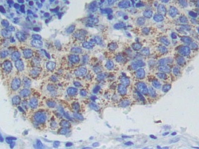 Polyclonal Antibody to Adenylate Cyclase 9 (ADCY9)