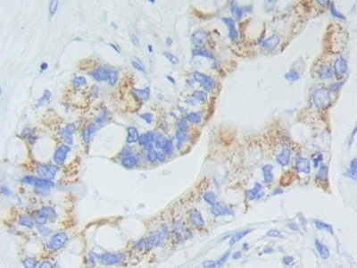 Polyclonal Antibody to Adenylate Cyclase 9 (ADCY9)