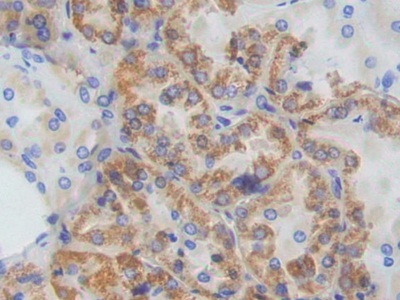 Polyclonal Antibody to Adenylate Cyclase 9 (ADCY9)