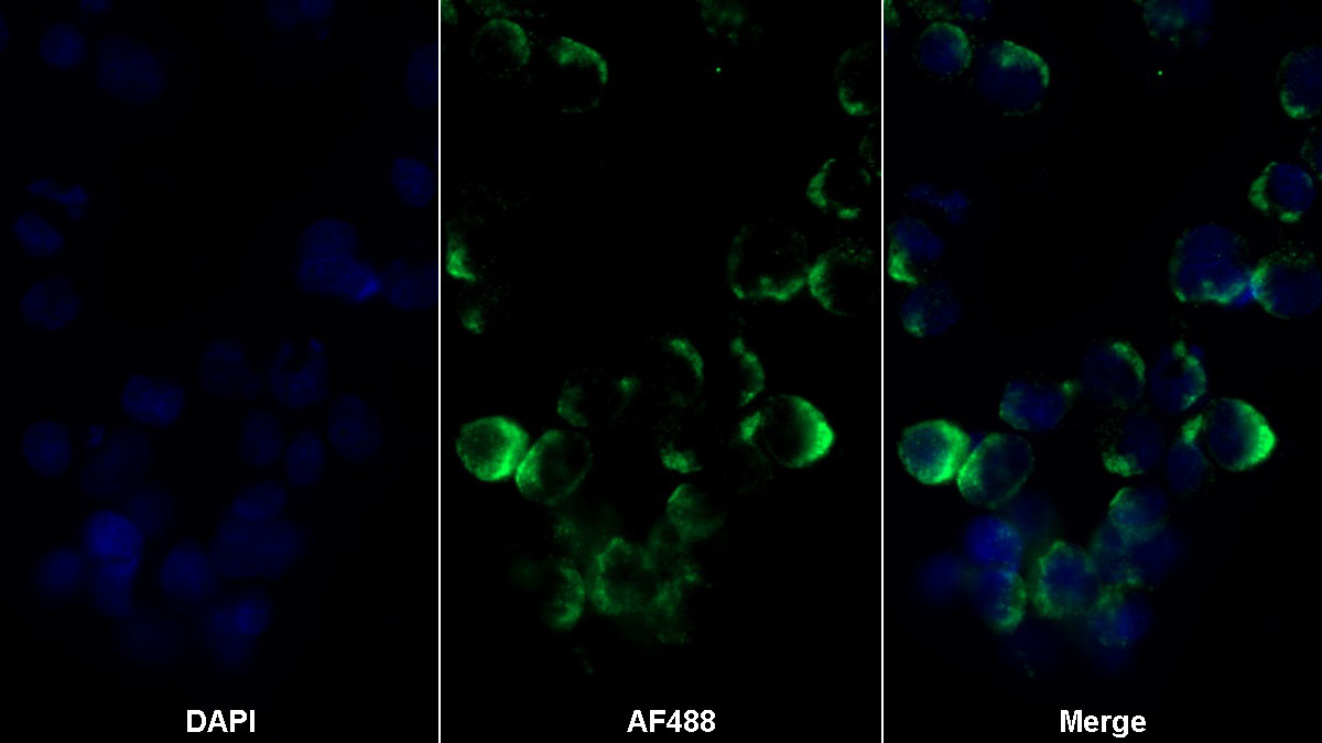 Polyclonal Antibody to Semaphorin 4D (SEMA4D)