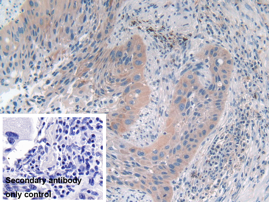 Polyclonal Antibody to Mitogen Activated Protein Kinase 7 (MAPK7)