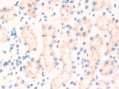 Polyclonal Antibody to Immunoglobulin Superfamily, Member 2 (IGSF2)