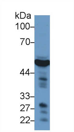 Polyclonal Antibody to Enolase 3 (ENO3)