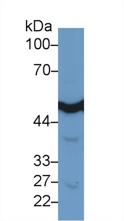 Polyclonal Antibody to Enolase 3 (ENO3)