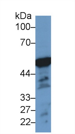 Polyclonal Antibody to Enolase 3 (ENO3)