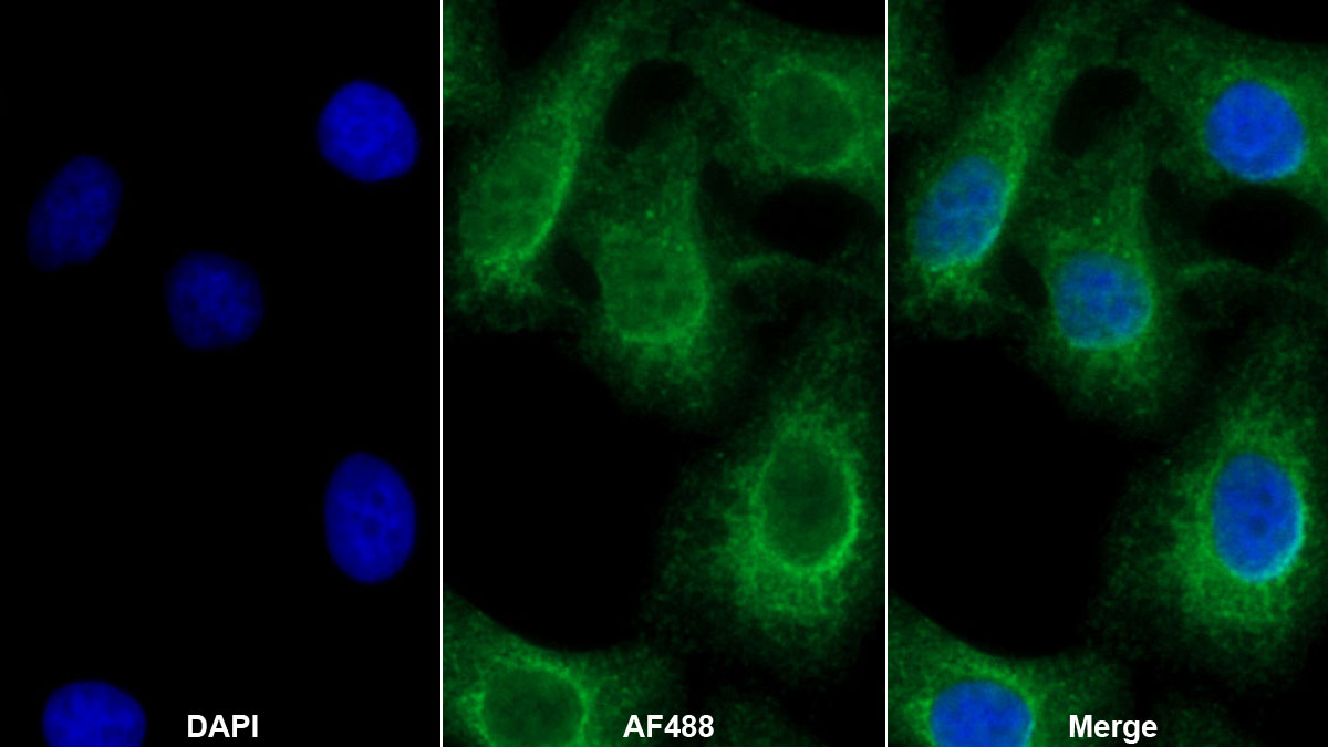 Polyclonal Antibody to Enolase 3 (ENO3)