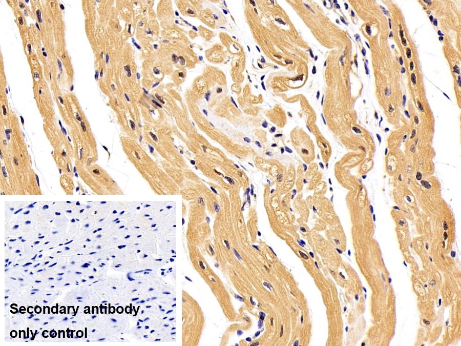 Polyclonal Antibody to Enolase 3 (ENO3)