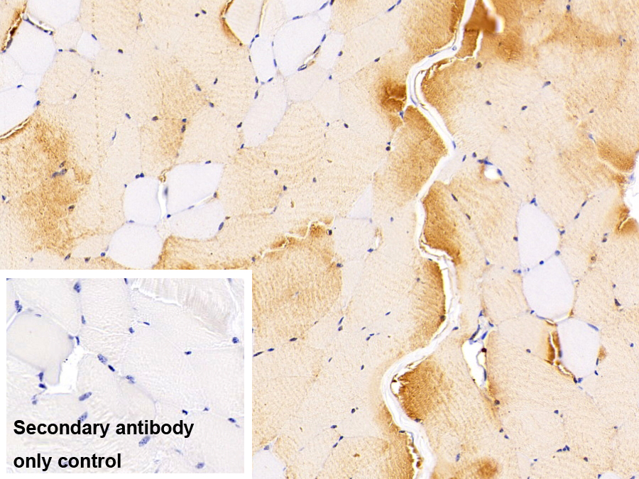 Polyclonal Antibody to Enolase 3 (ENO3)