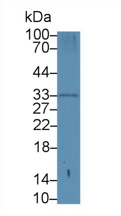 Polyclonal Antibody to Proteinase 3 (PR3)