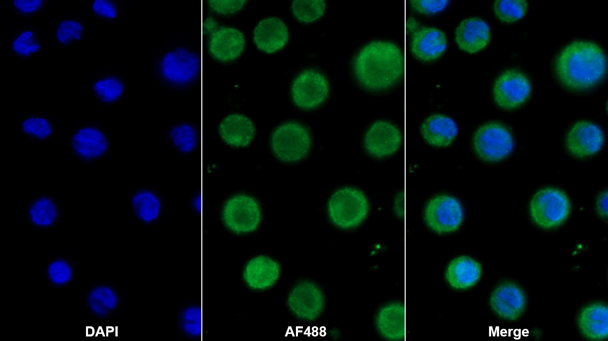 Polyclonal Antibody to Proteinase 3 (PR3)