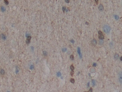 Polyclonal Antibody to Mitogen Activated Protein Kinase 11 (MAPK11)