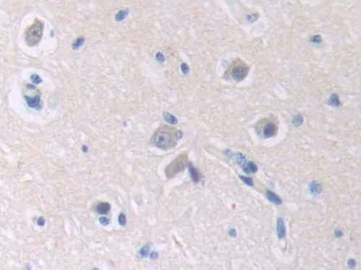 Polyclonal Antibody to Macrophage Erythroblast Attacher (MAEA)