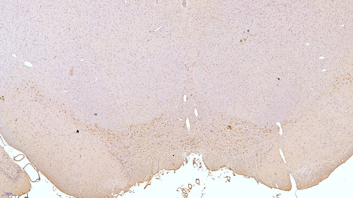 Polyclonal Antibody to Tyrosine Hydroxylase (TH)