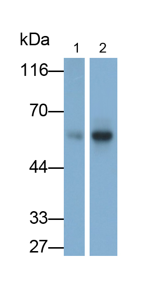 Polyclonal Antibody to Tyrosine Hydroxylase (TH)