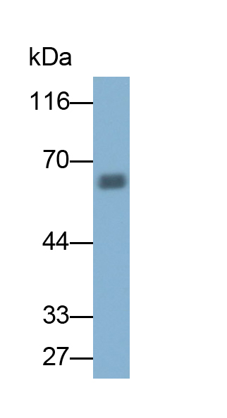 Polyclonal Antibody to Tyrosine Hydroxylase (TH)