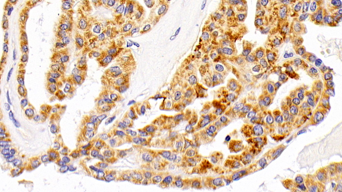 Polyclonal Antibody to Lysosomal Associated Membrane Protein 1 (LAMP1)