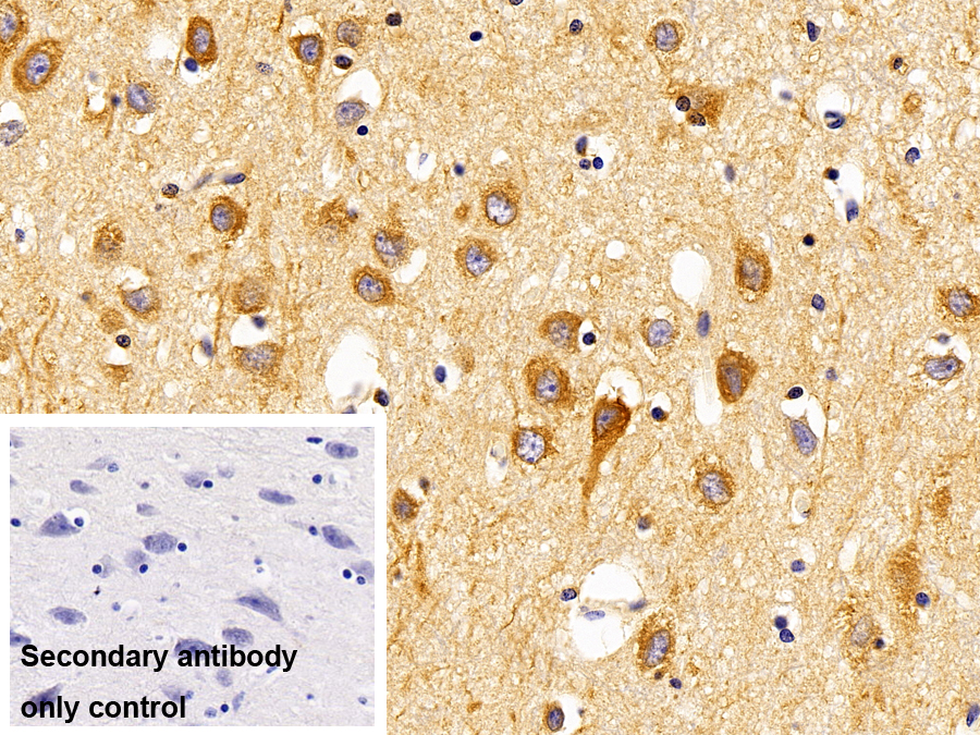 Polyclonal Antibody to Lysosomal Associated Membrane Protein 1 (LAMP1)