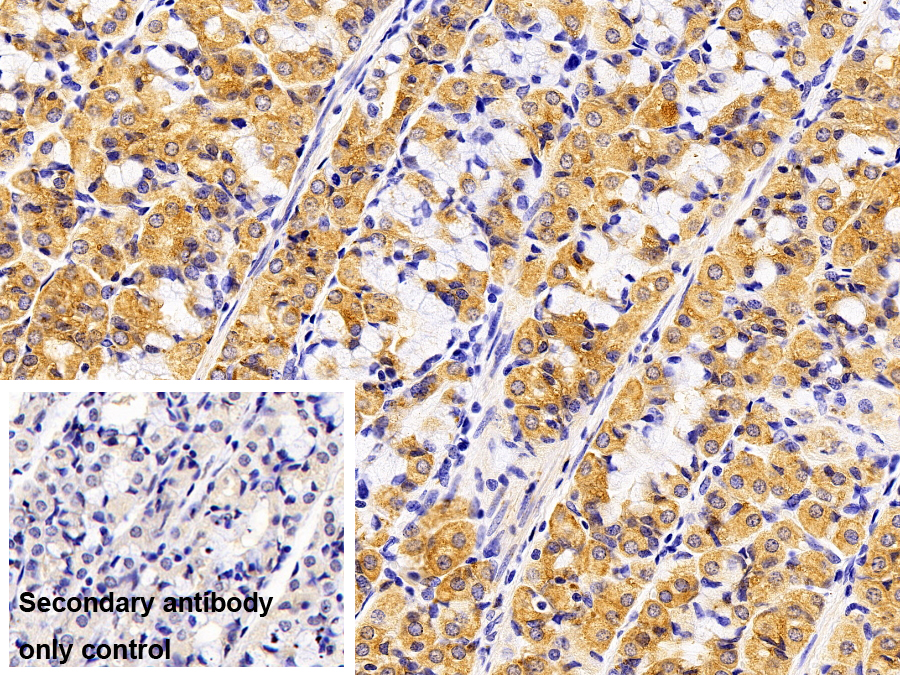 Polyclonal Antibody to Lysosomal Associated Membrane Protein 1 (LAMP1)