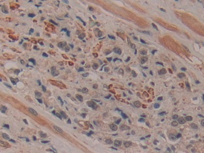 Polyclonal Antibody to Ribonuclease Inhibitor (RI)