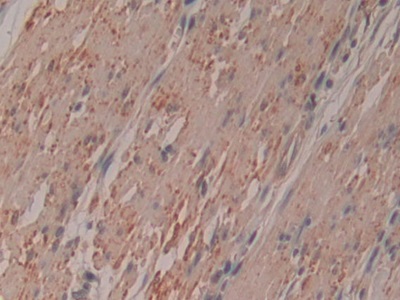 Polyclonal Antibody to Ribonuclease Inhibitor (RI)