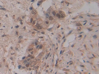 Polyclonal Antibody to Ribonuclease Inhibitor (RI)