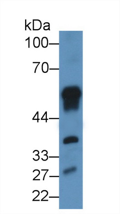 Polyclonal Antibody to Ribonuclease Inhibitor (RI)