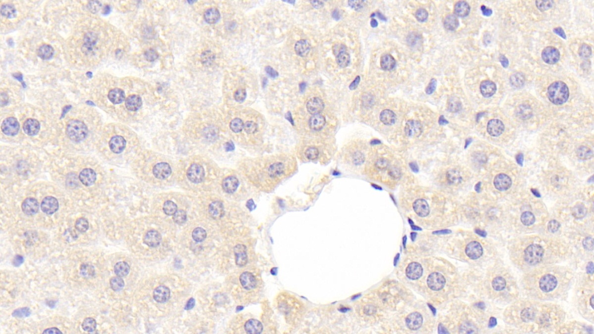 Polyclonal Antibody to Ribonuclease Inhibitor (RI)