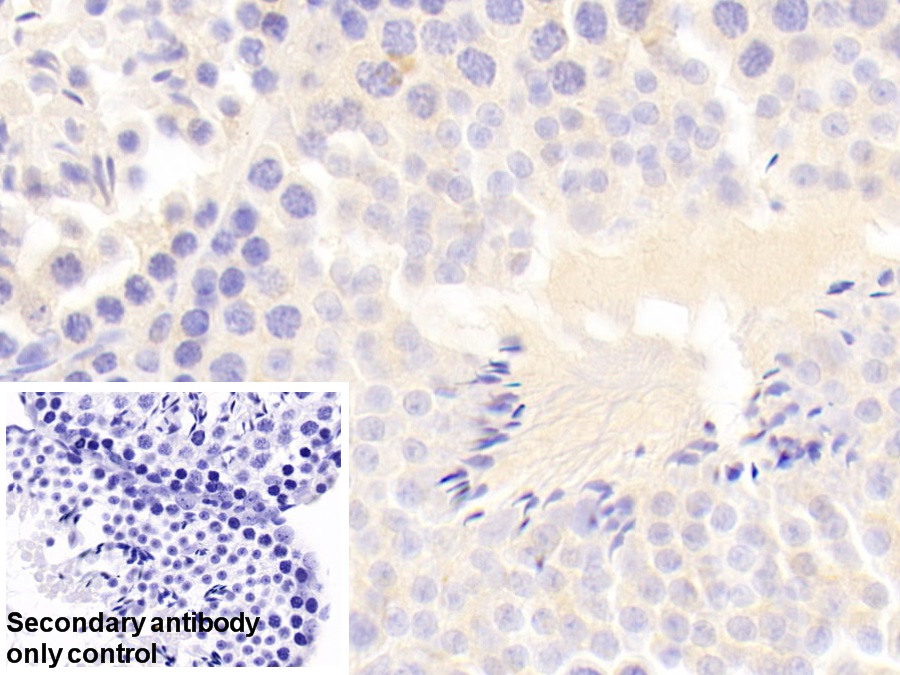 Polyclonal Antibody to Ribonuclease Inhibitor (RI)