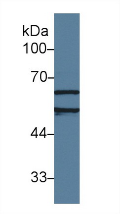 Polyclonal Antibody to Acetylcholinesterase (ACHE)