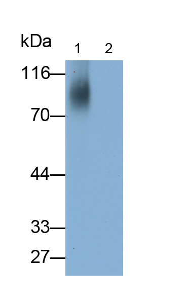 Polyclonal Antibody to Carnosine (Car)