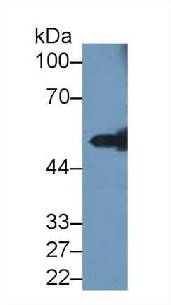 Polyclonal Antibody to Pancreatic Lipase (PL)