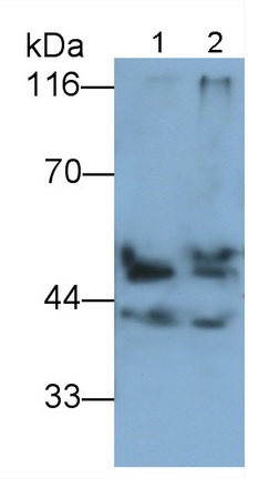 Polyclonal Antibody to Pancreatic Lipase (PL)