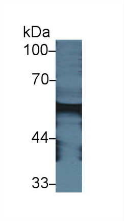 Polyclonal Antibody to Amylase, Alpha 2A (AMY2A)