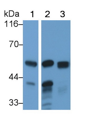 Polyclonal Antibody to Amylase, Alpha 2A (AMY2A)