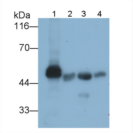 Polyclonal Antibody to Amylase, Alpha 2A (AMY2A)