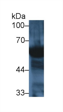 Polyclonal Antibody to Amylase, Alpha 2A (AMY2A)