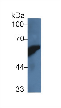 Polyclonal Antibody to Amylase, Alpha 2A (AMY2A)