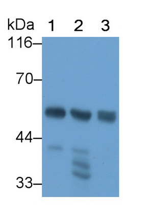 Polyclonal Antibody to Amylase, Alpha 2A (AMY2A)